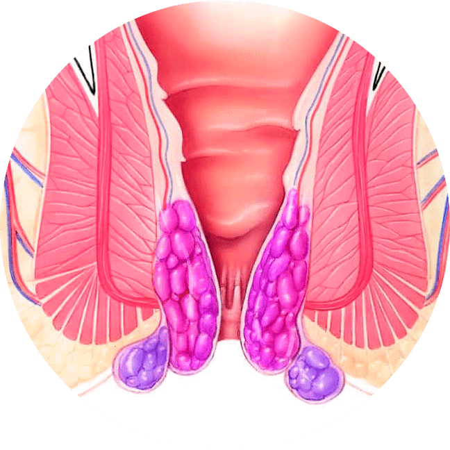Gelarex alivia os sintomas desde o primeiro uso